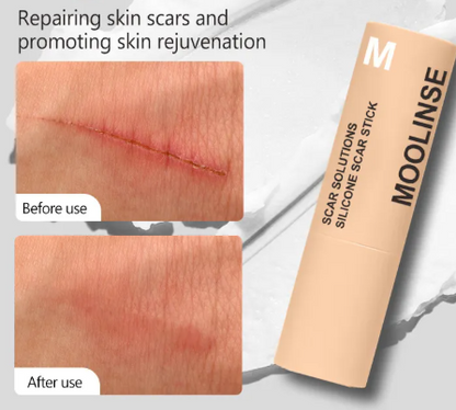 Silicone Scar Stick